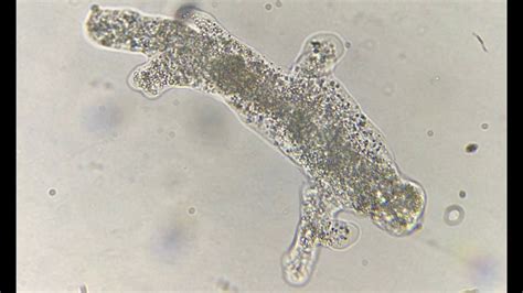  阿米巴蟲，這隻微型生物究竟如何以偽足在水底自由遊動？