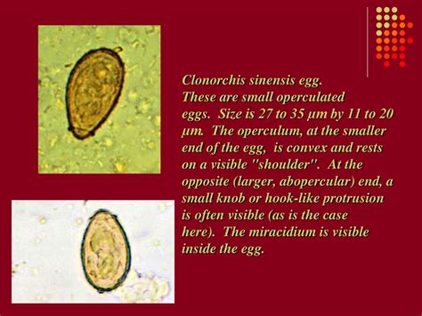  Clonorchis！一種寄生在膽囊的「小」食客