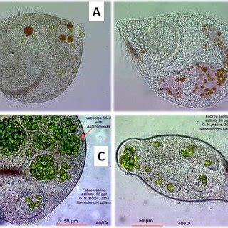  Heterotrichous Ciliate，A Tiny Dancer Spinning Stories Of Survival!